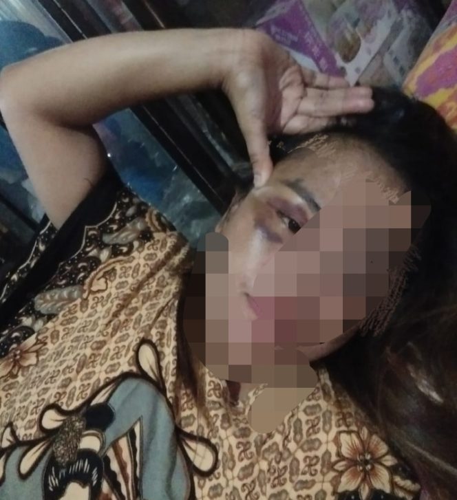 
 Kasus Dugaan KDRT Yang Ditangani Polres Malang Dinilai Masyarakat Lamban dan Tertutup