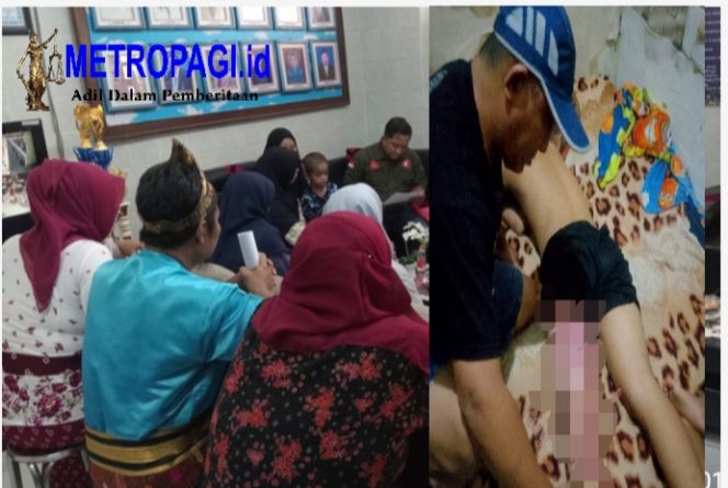 
 Ironi Ketika Salah Satu Siswa SMPN 1 Pasuruan Luka Bakar Disekujur Tubuh, Pulang Malah Diantar Teman, Dimana Letak Hati Nurani Sang Guru
